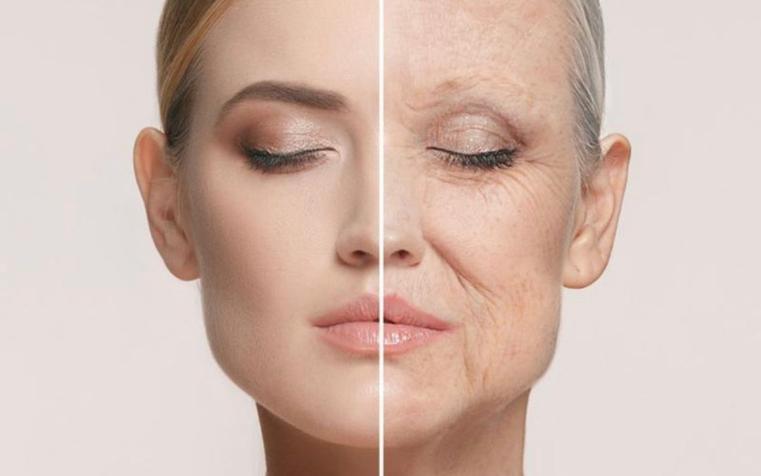 Zmarszczki głębokie – problem osób nie tylko po 40-ce