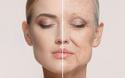 Zmarszczki głębokie – problem osób nie tylko po 40-ce