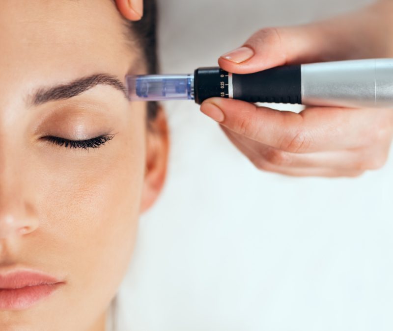 Mezoterapia mikroigłowa skóry twarzy – jak przygotować się do zabiegu?